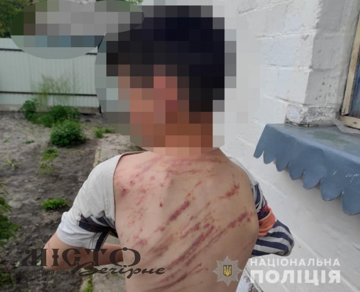 У селі Володимир-Волинського району вітчим побив 13-річного пасинка 