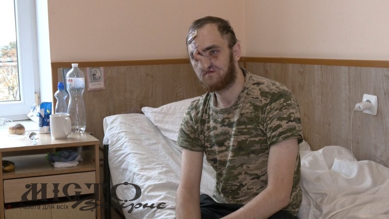 Військовому з Володимира лікарі відновлюють обличчя після поранення 