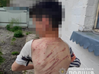 У селі Володимир-Волинського району вітчим побив 13-річного пасинка - новини Володимир-Водинського У селі Володимир-Волинського району вітчим побив 13-річного пасинка