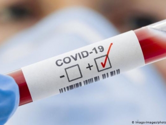 Ситуація з поширенням COVID-19 на 1 березня у Володимирі 