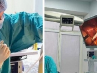 У Володимирському ТМО лікарі видалили пацієнтці матку та жовчний міхур за одну операцію 
